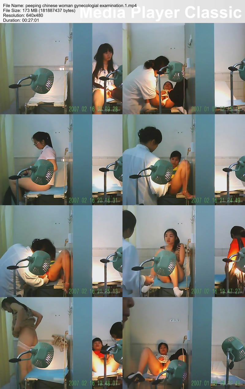 peeping chinese woman gynecologial examination.1